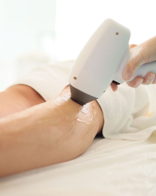 At-home IPL hair removal device being used on a leg for permanent hair reduction