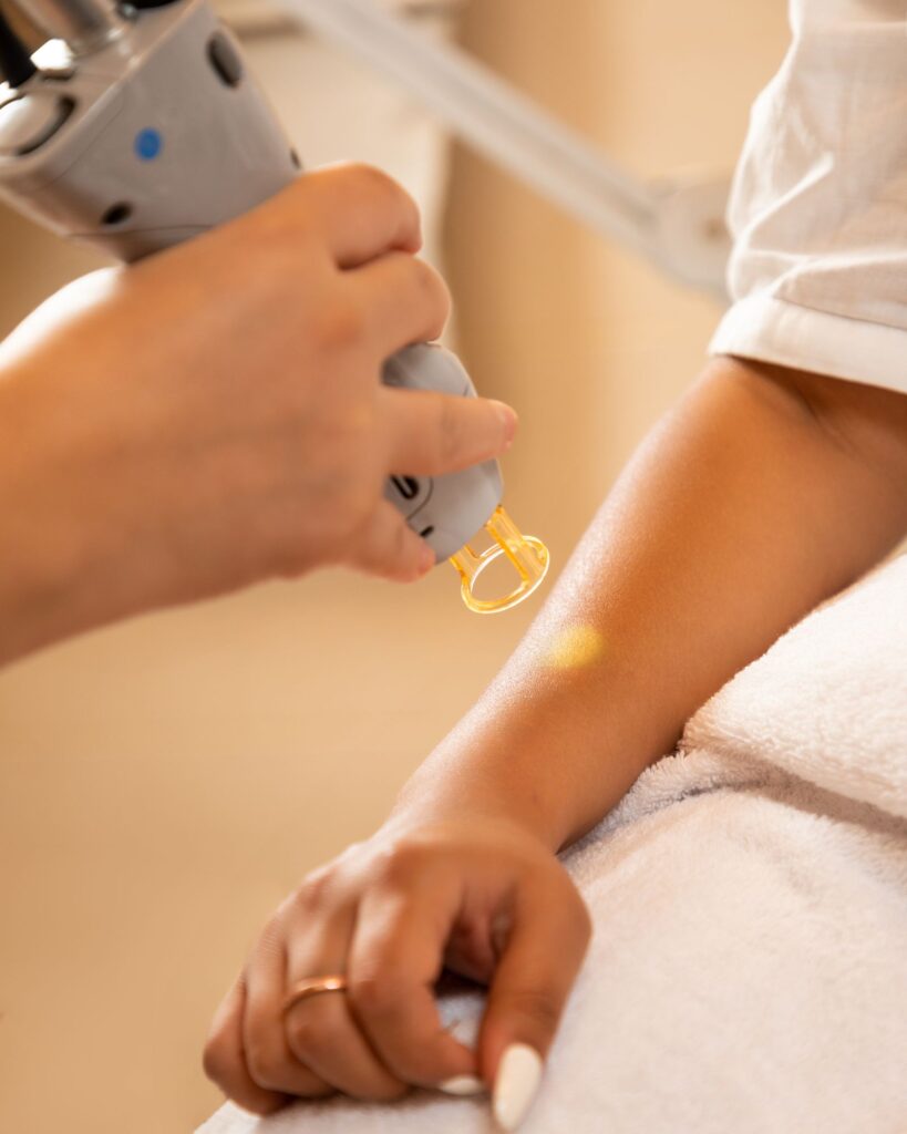 Electrolysis vs laser vs IPL compared during a laser hair removal session on the arm