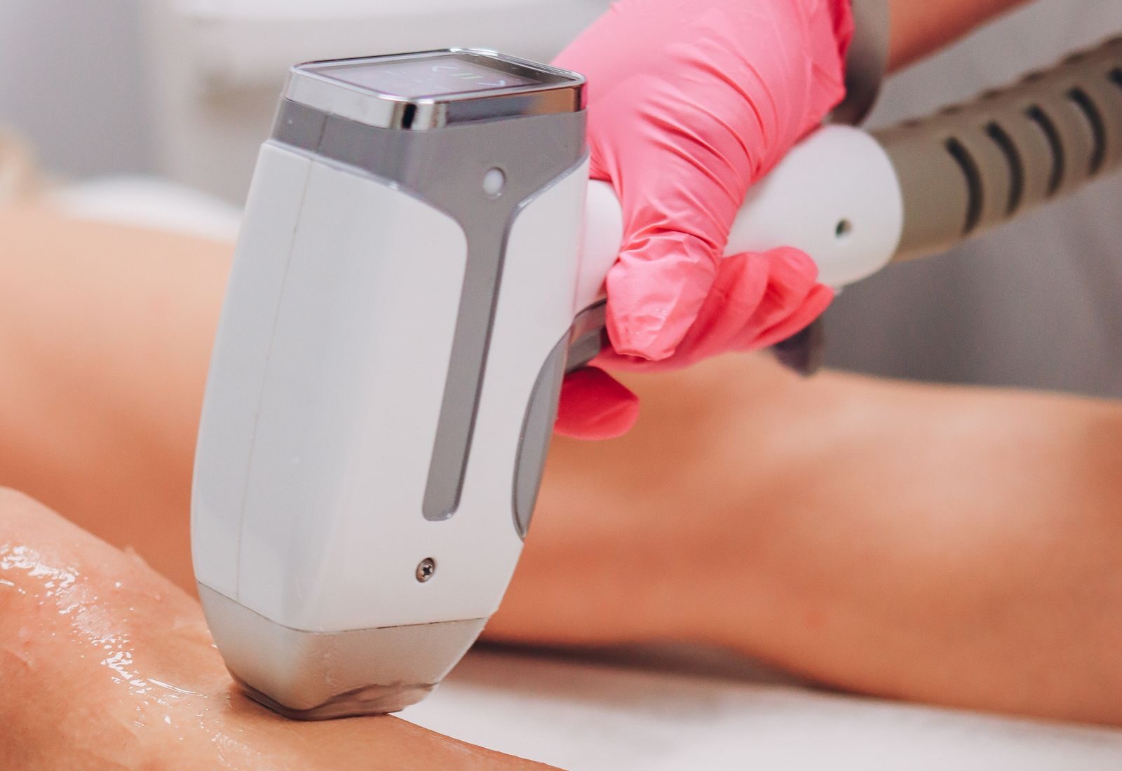 Full body laser hair removal cost illustrated by a clinic leg treatment session