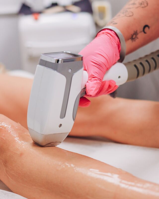 Full body laser hair removal cost illustrated by a clinic leg treatment session