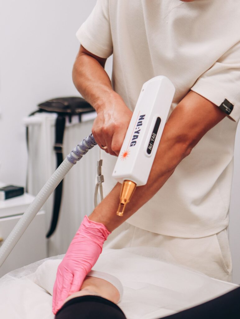Full body laser hair removal using an Nd:YAG laser, the safer wavelength for deeper skin tones