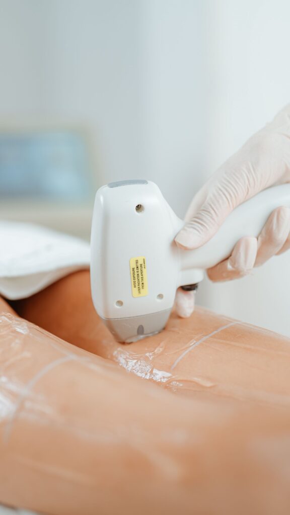 Gloved practitioner using a laser hair removal handpiece on a thigh with cooling gel