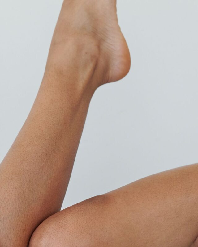 Close-up of shaved legs with visible dark follicle dots, the look known as strawberry legs