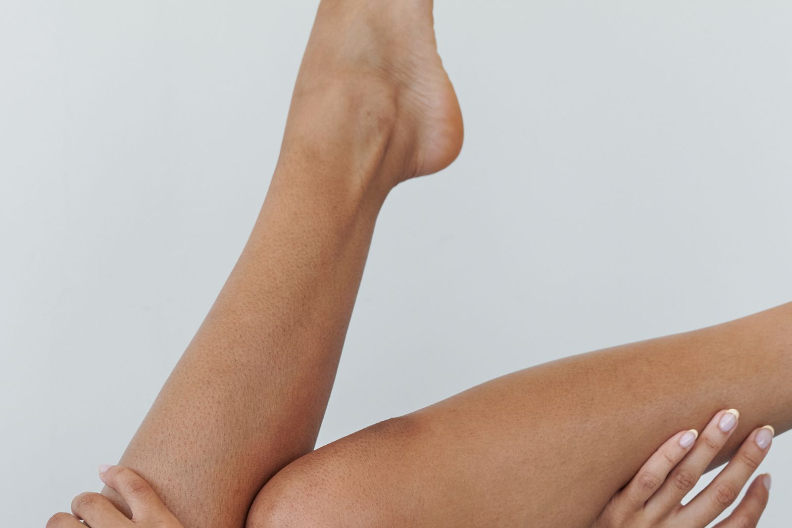 Close-up of shaved legs with visible dark follicle dots, the look known as strawberry legs