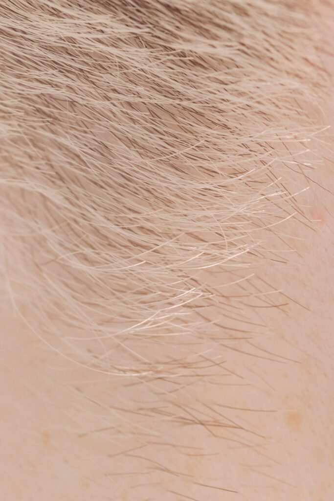 Fine pale vellus hair beside darker terminal hair, the change people blame when asking does shaving make hair grow back thicker